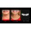 NeckTITE Magic - The Instant Neck Lift (2 pack) 2