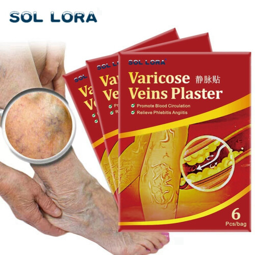 Vein Patch Relieve Leg Veins And Earthworms 2