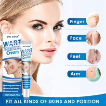 Wart Removal Cream Wart Flat Corn Cream Flat Wart Wart Moxa Cream