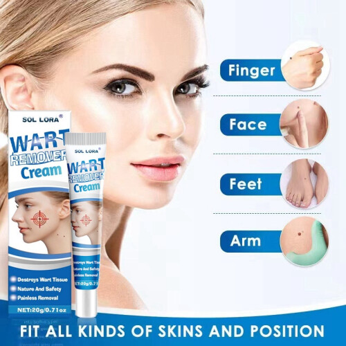 Wart Removal Cream Wart Flat Corn Cream Flat Wart Wart Moxa Cream