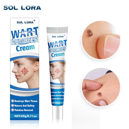 Wart Removal Cream Wart Flat Corn Cream Flat Wart Wart Moxa Cream 1