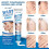 Wart Removal Cream Wart Flat Corn Cream Flat Wart Wart Moxa Cream 3
