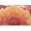 Periogen Complete Mondgezondheidsspoeling (3-PK) 5