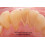 Periogen Complete Mondgezondheidsspoeling (3-PK) 4