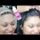 Dolahair Κιτ Κόλλας Lace Front για Περούκες Waterproof Ισχυρή Κόλλα Περούκας 2