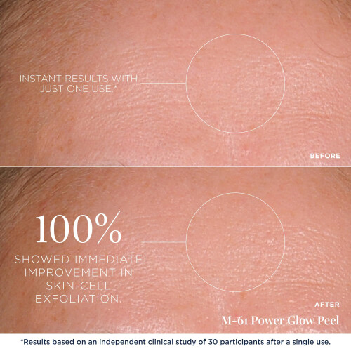 M-61 PowerGlow Peel- 10 Θεραπείες- 1 λεπτό, 1 βήμα απολεπιστική μάσκα 2