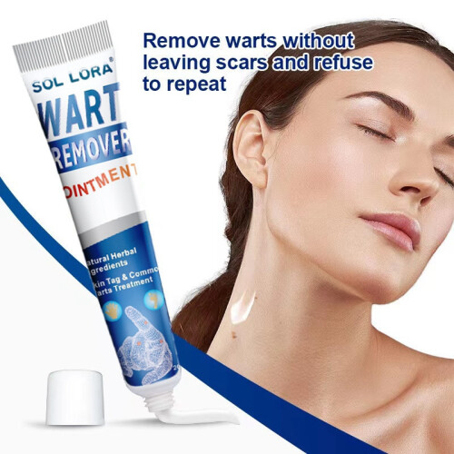 Wart Removal Cream Wart Removal Cream Corn Ointment Flat Wart Wart Wart Wart 1