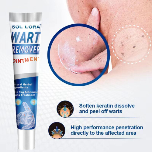 Wart Removal Cream Wart Removal Cream Corn Ointment Flat Wart Wart Wart Wart 2