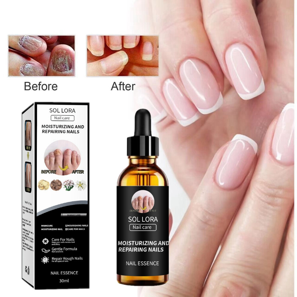 Yetp Star Nail Repair Solution Thickening Bright Nail Removal Onychomycosis Skin Repair Moisturizing Nail Care Solution