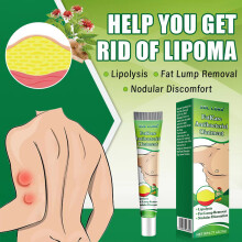 Fat Caulking Paste Relieves Fat Caulking Subcutaneous Mass Made In The Body Care Fat Care