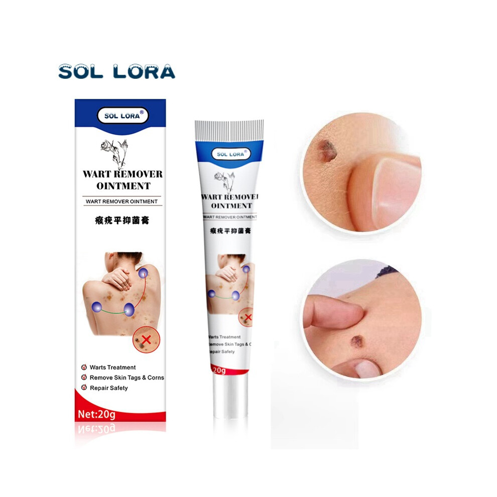 Yetp Star Cream Wart Removal Wart Removal Wart Corn Moth Spot