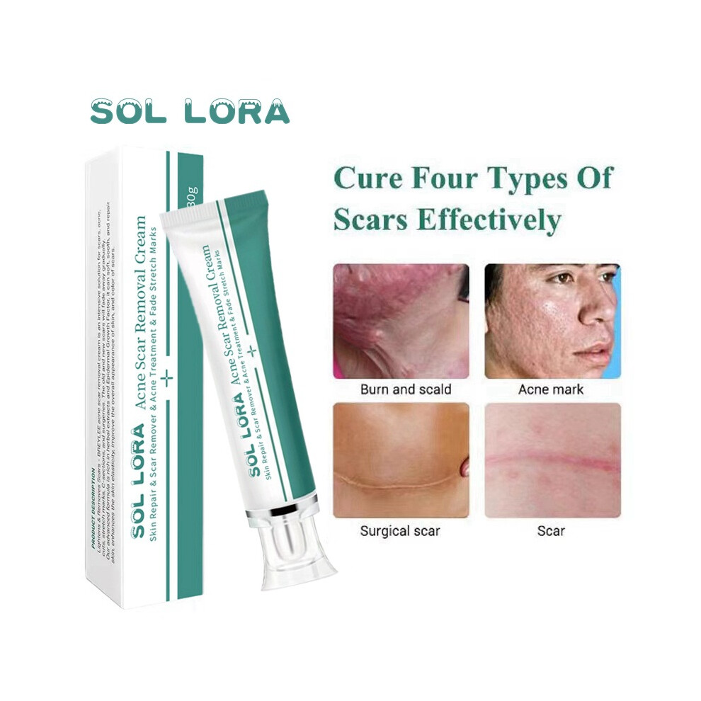 Yetp Star Cream Skin Repair Fades Scars