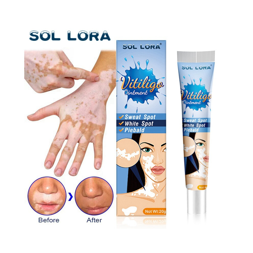 Yetp Star Cream/White Spot Care Health Spot Cleansing Ointment Spot Sweat Spot Vitiligo Vitiligo Skin External