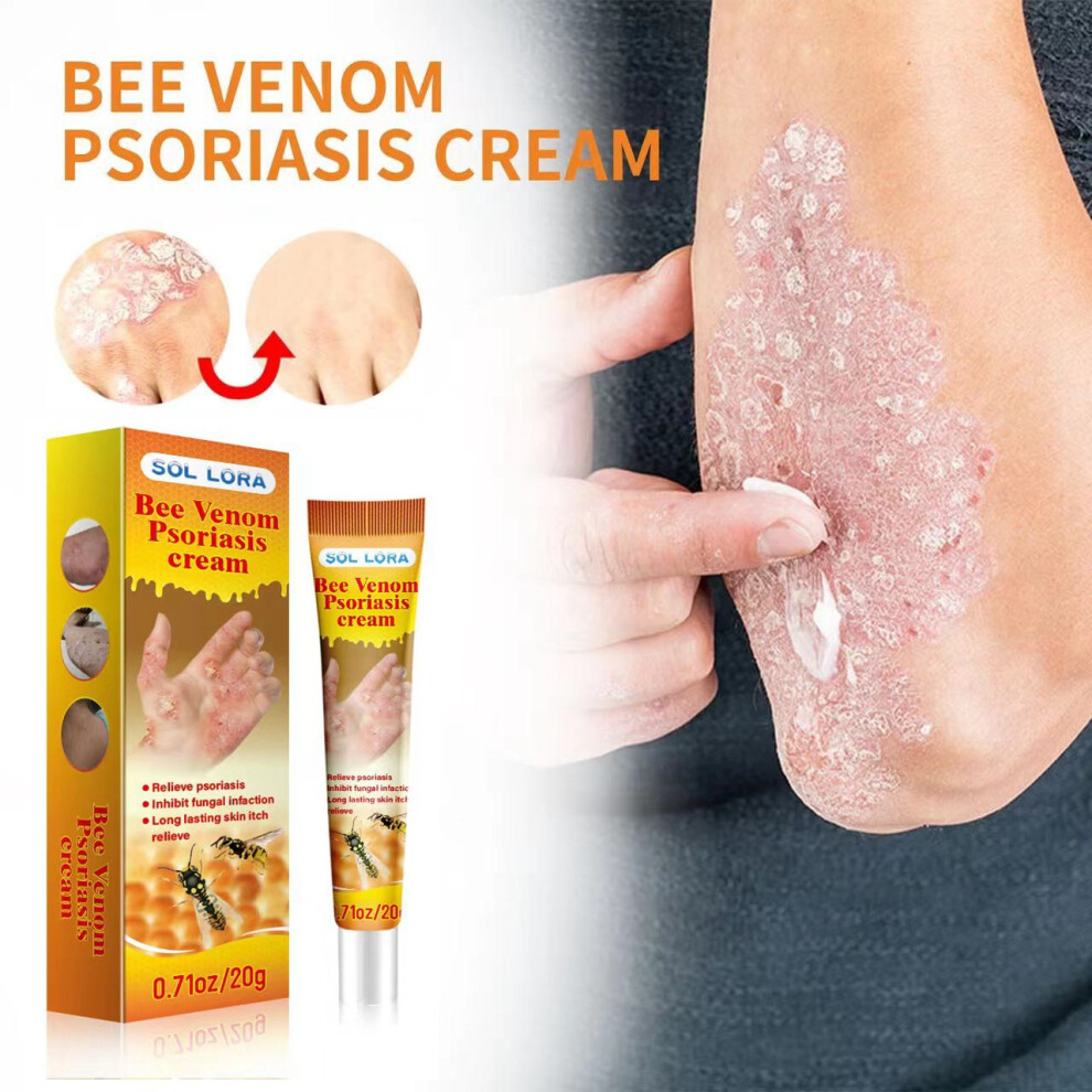 Yetp Star Cream Bee Venom Relieves Skin Itching And Repairs Hand And Foot Moss Skin Repair