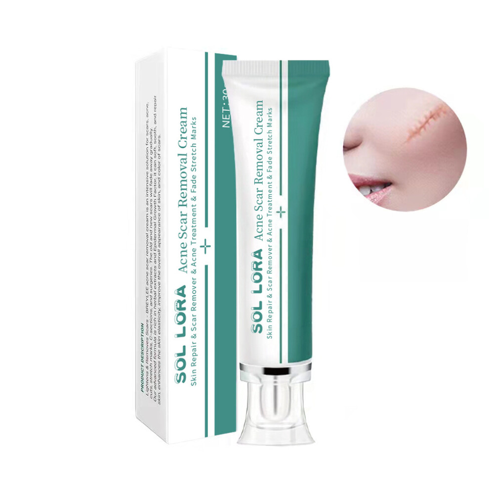 Yetp Star Cream Scar Repair Caesarean Section Injury Fades And Acne Removal Scars