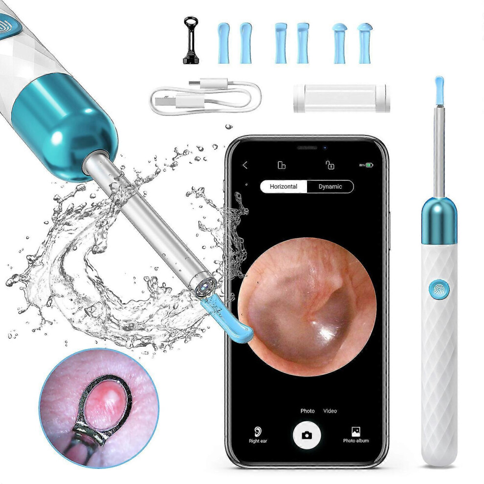 White (White) Earwax Remover Otoscope, Wifi Ear Camera Endoscope, 1080P Hd Wireless Waterproof Ear Mirror, Ear Cleaning Kit For Android And Ios