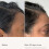 Living Proof Scalp Care Density Serum 3