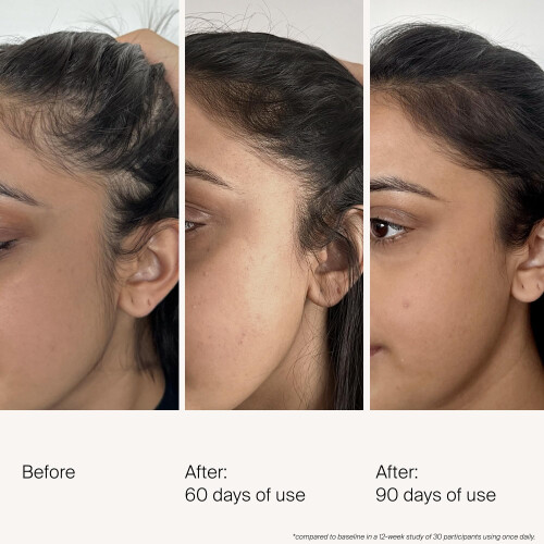 Living Proof Scalp Care Density Serum 1