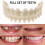 Smile Snap On Upperbottom Set False Teeth Denture Veneers Dental Tooth Cover 1