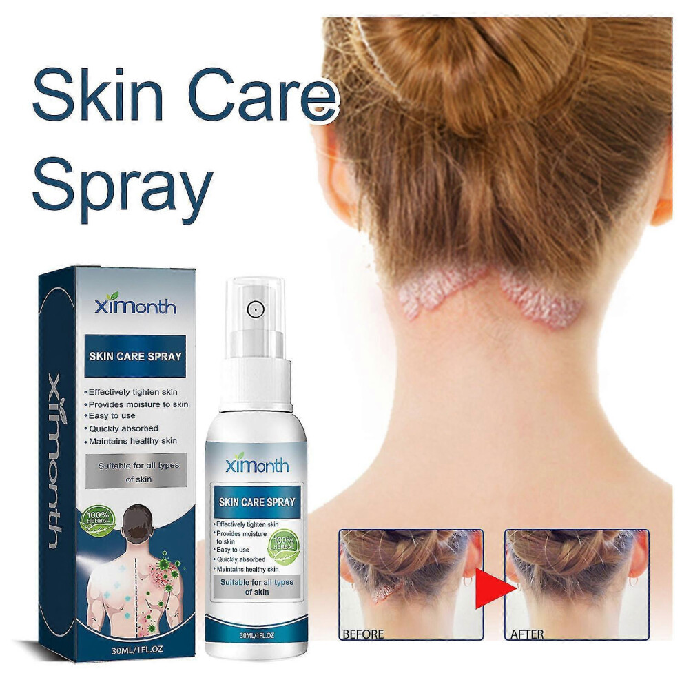 (2pcs) Psoriasis Treatment Spray Scalp Recovery Therapy, Scalp Psoriasis Treatment Spray, Skin Recovery Psoriasis Control Moisturizing Spray