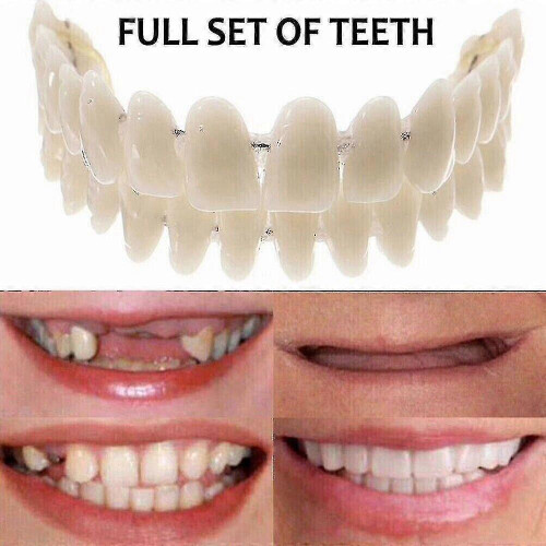 Smile Snap On False Teeth Upper Lower Dental Veneers Dentures Tooth Cover Set Tw
