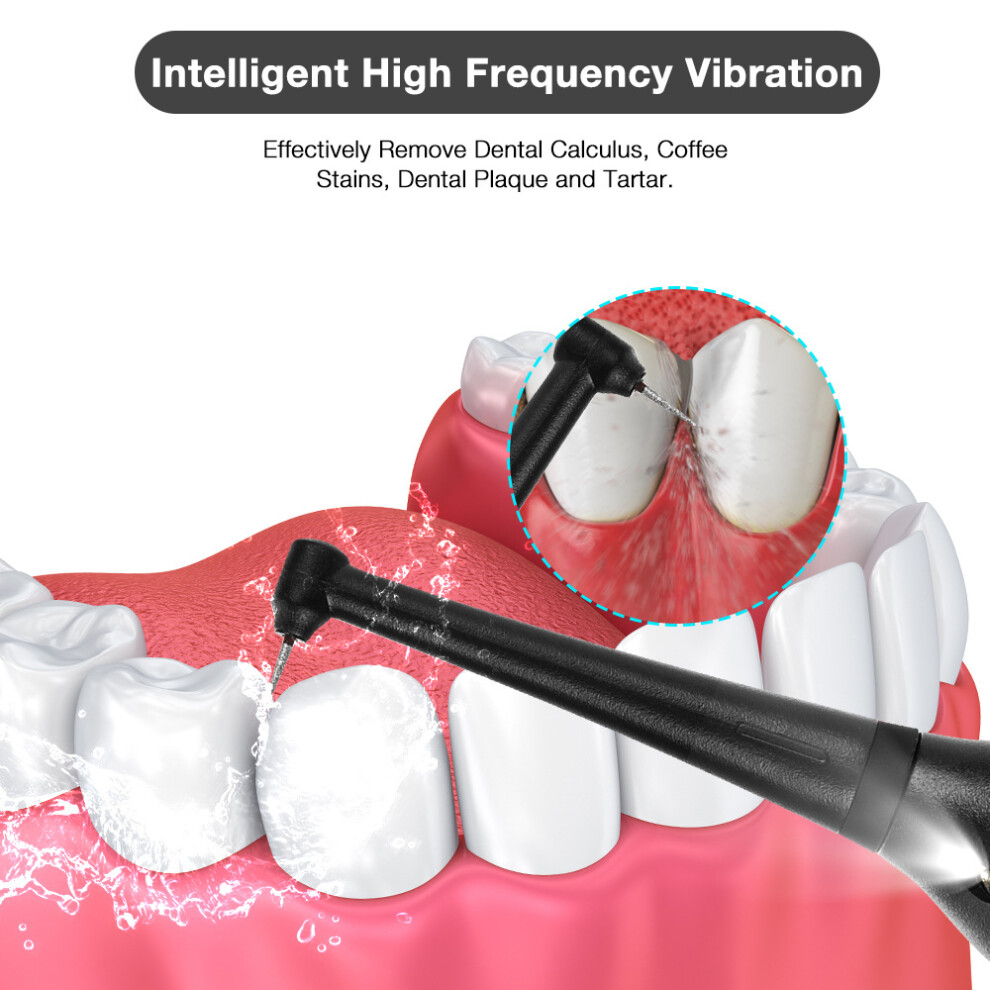 Lifeasy Ultrasonic Dental Scaler For Teeth Tartar Tooth Stain Dental Calculus Remover Electric Sonic Teeth Plaque Cleaner Dental Stone Removal I