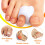 Toe Separators, 8 Pieces Big Toe Separator Hammer Toe Straightener Overlapping Toes 4