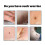Skin Wart Eliminator Soaps 3