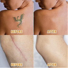 (AA004) 5 Pack Breathable Tattoo Flaw Concealing Tape, Scars Flaw Cover Up Tape Stickers