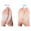 Emjoi MicroPedi 3D POWER Callus Remover Twice as effective  with unique 3D Motion 4