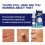 Wart Removal Spray Wart Pest Care Solution Cock Eye Grain Care Solution 3
