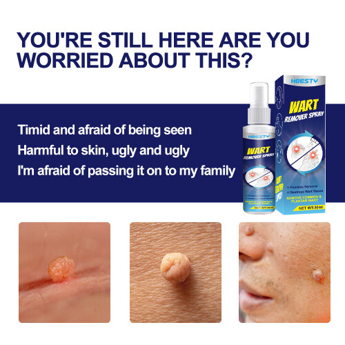 Wart Removal Spray Wart Pest Care Solution Cock Eye Grain Care Solution 2