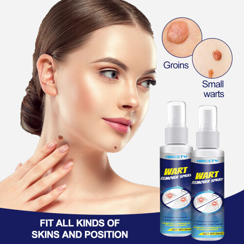 Wart Removal Spray Wart Pest Care Solution Cock Eye Grain Care Solution 1