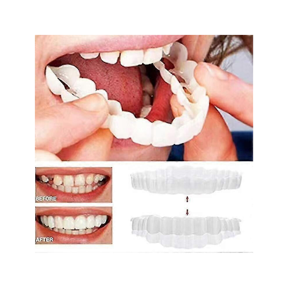 Braces Snap On Upper Fake Teeth Dental Veneers Denture Cover Setbraces Snap On Upper Fake Teeth Dental Veneers Denture Cover Set