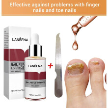 YETP STAR LANBENA Nail Repair Essence Seerumi Anti Fungal Nail hoito Poista