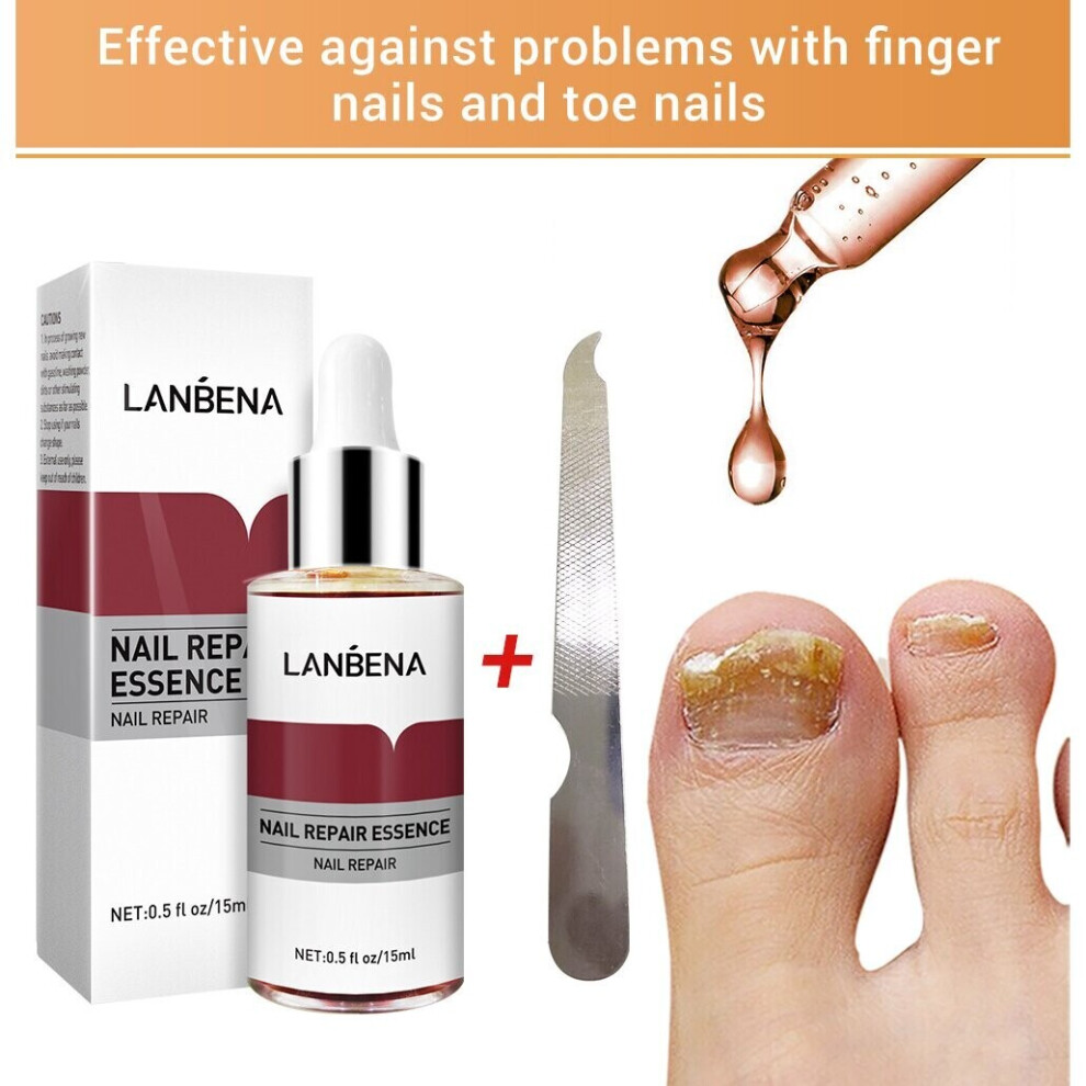 Yetp Star Lanbena Nail Repair Essence Serum Anti Fungal Nail Treatment Remove