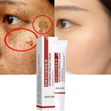 Crema sbiancante per le lentiggini Rimuovi le macchie scure Crema anti-lentiggini Niacinamide Dissolvenza