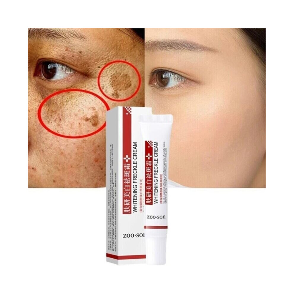 Whitening Freckle Cream Remove Dark Spots Anti-Freckle Cream Niacinamide Fade