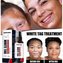 2023 Dermax White Tag Treatment Feuchtigkeitsspendendes Körperspray
