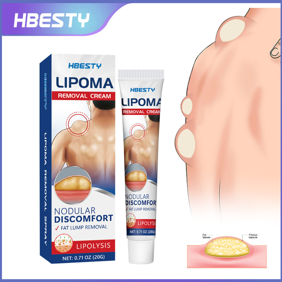 Mdsrjone Cream Fat Kang Fat Clump Fat Particles Subcutaneous Lump Bulge Care