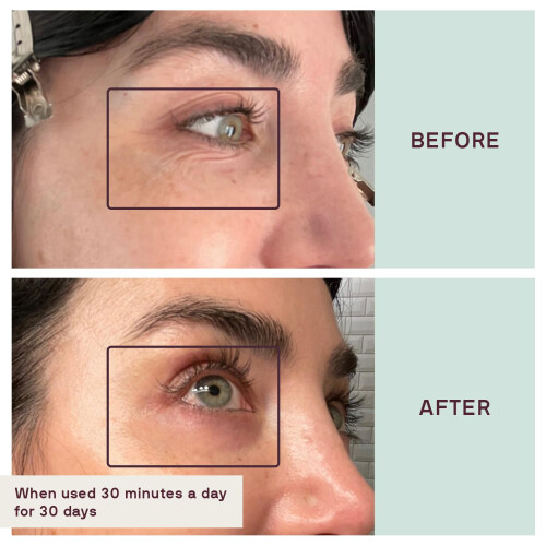 Conjunto de Beleza Sem Idade Dermaclara - Inclui 4 Patches para Olhos e Boca, 1 Patch para Testa, 1 Patch para Pescoço 2