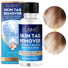 Wart Removal Solution Bottles, Wart Removal, Wart Removal, Corns, Meat Thorns, Flat Warts, Sharp Silk