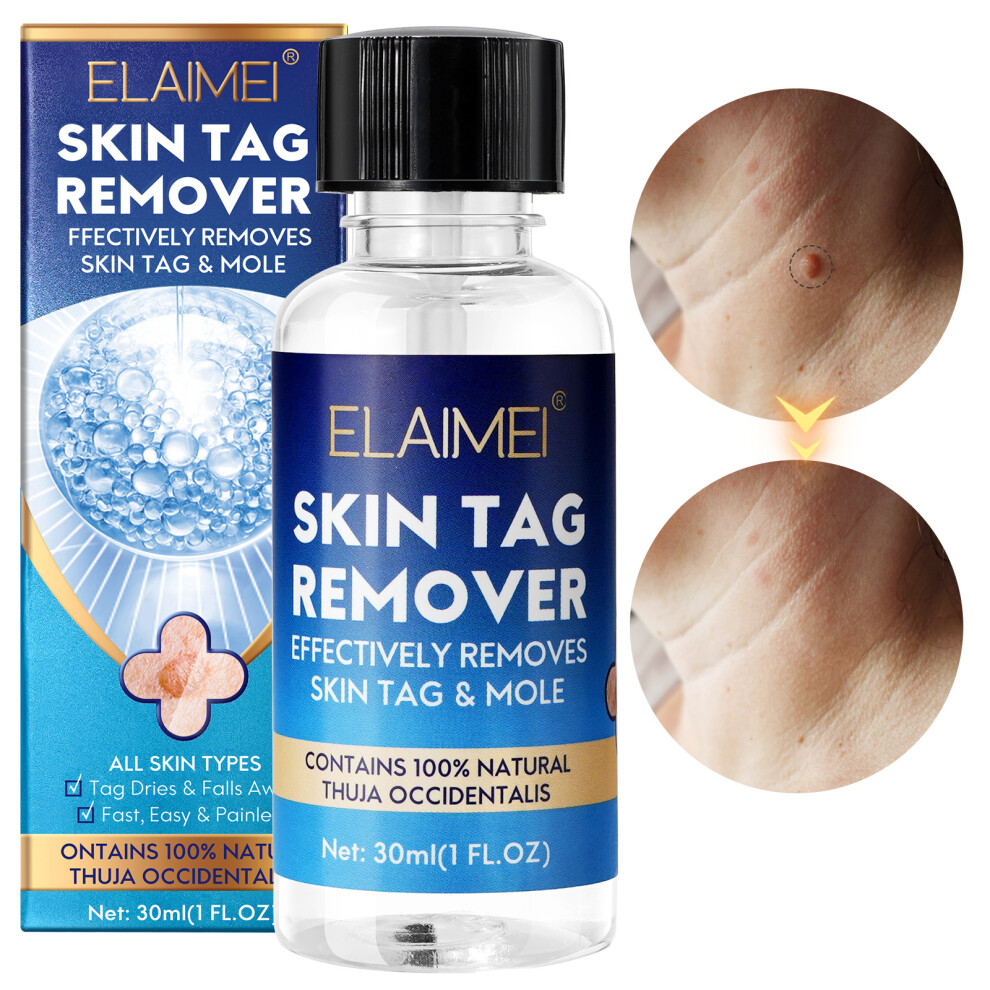Bghone Wart Removal Solution Bottles, Wart Removal, Wart Removal, Corns, Meat Thorns, Flat Warts, Sharp Silk