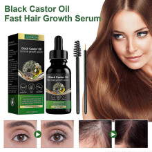Black Castor Oil Fast Hair Growth Serum Ginger Mint Oil 60ml Clearance