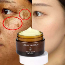 Whitening Cream Retinol Removes Melasma Acne Spots Pigment Dark Spots Pigment