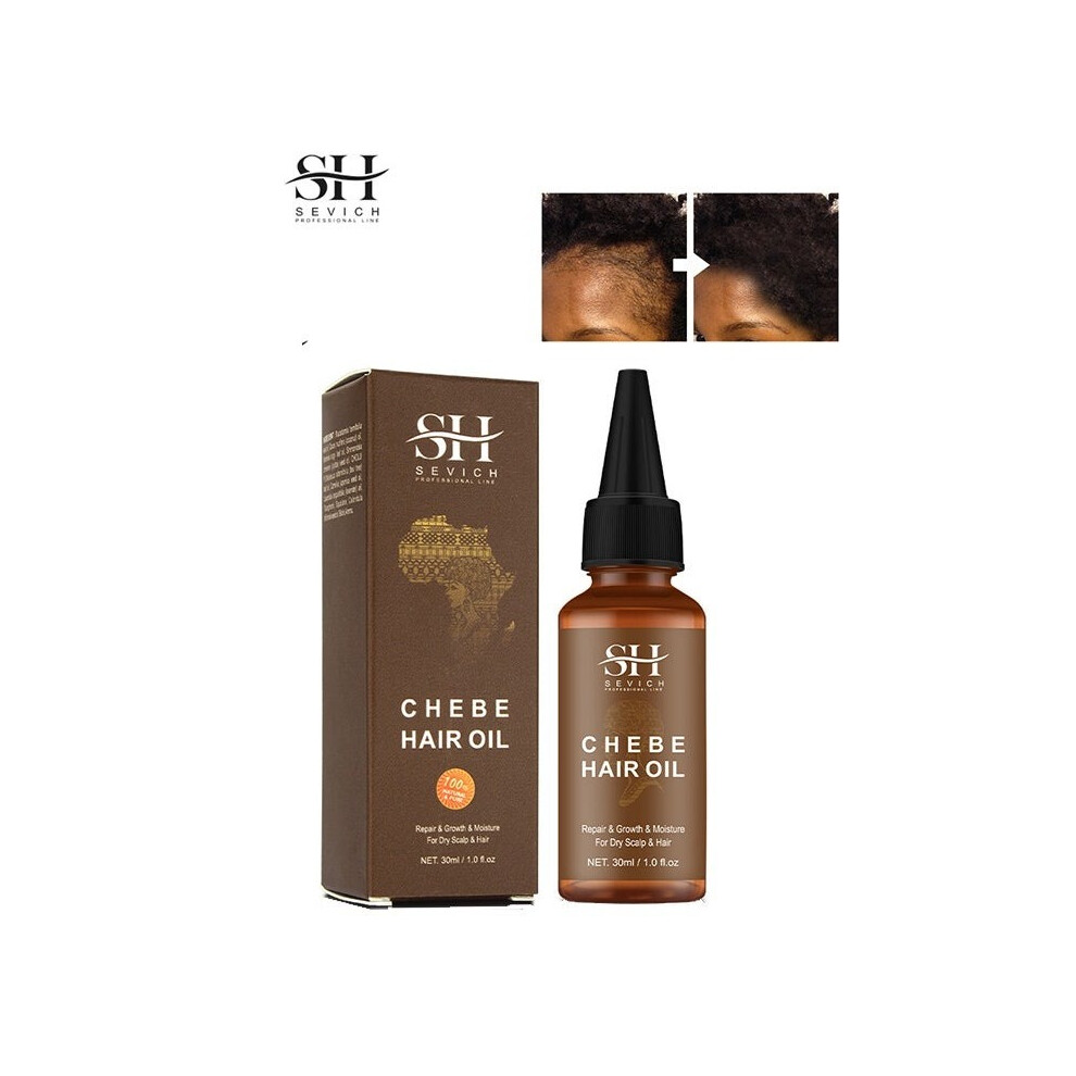 Sevich 100% Naturals Chebe Hair Oilï¼African Chebe Powder Serum, Hair Loss Treatments Repair Damaged Moisture Hair Regrowth - 30ml