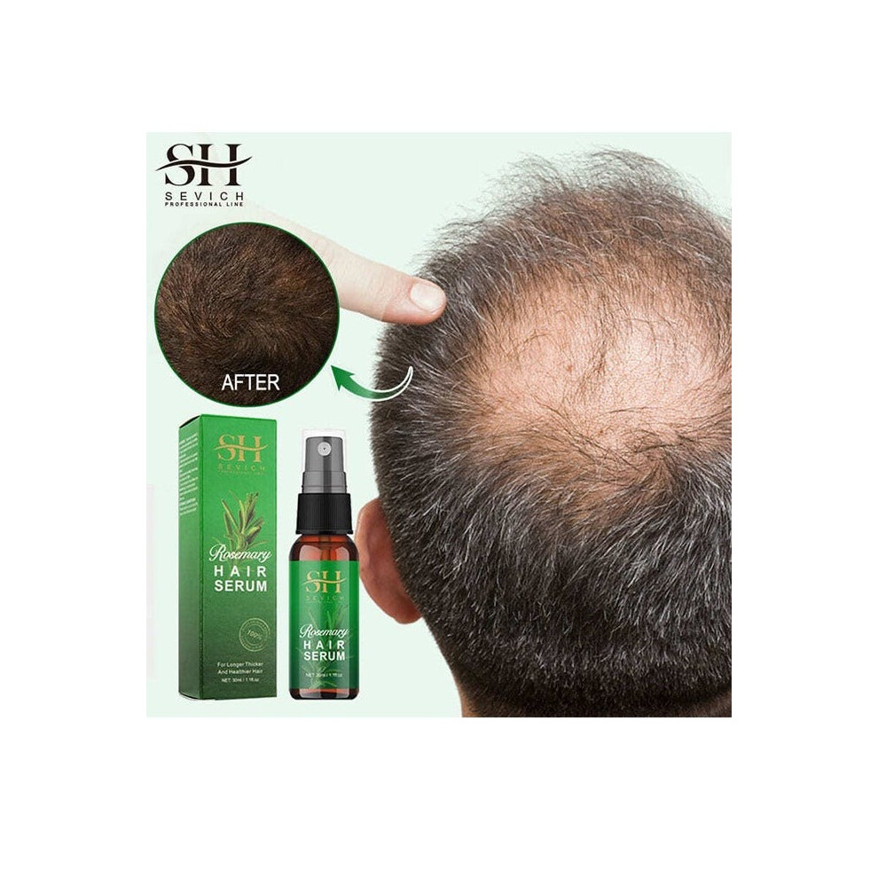 Light Sevich Rosemary Serum Hair Growth & Loss Regrowth, Strengthens Hair Nourishes Scalp Weight No Greasy Improves Scalp Circulation - 30Ml