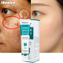 iBeaLee valkaiseva pisamavoide Poista melasma tummat läiskät Anti-Aging kerma 20ml