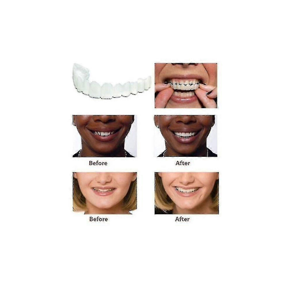 Furtalk (As Show, One Size) A Pair Upper & Lower High Quality Denture Instant Smile Comfort