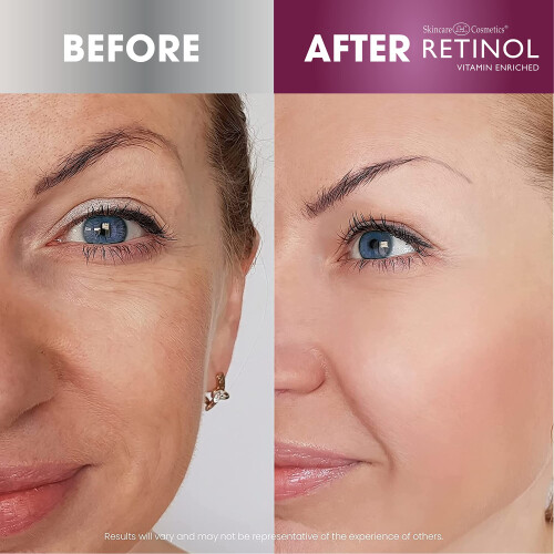Κρέμα νύχτας & ημέρας εμπλουτισμένη με Retinol - 24ΩΡΗ περιποίηση για νεανικό δέρμα 1